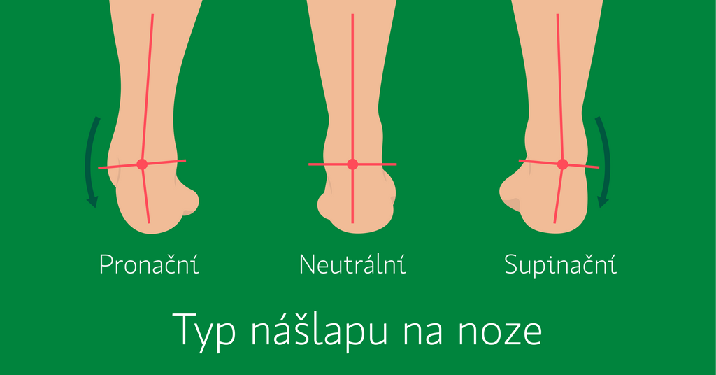 typ nášlapu nohy